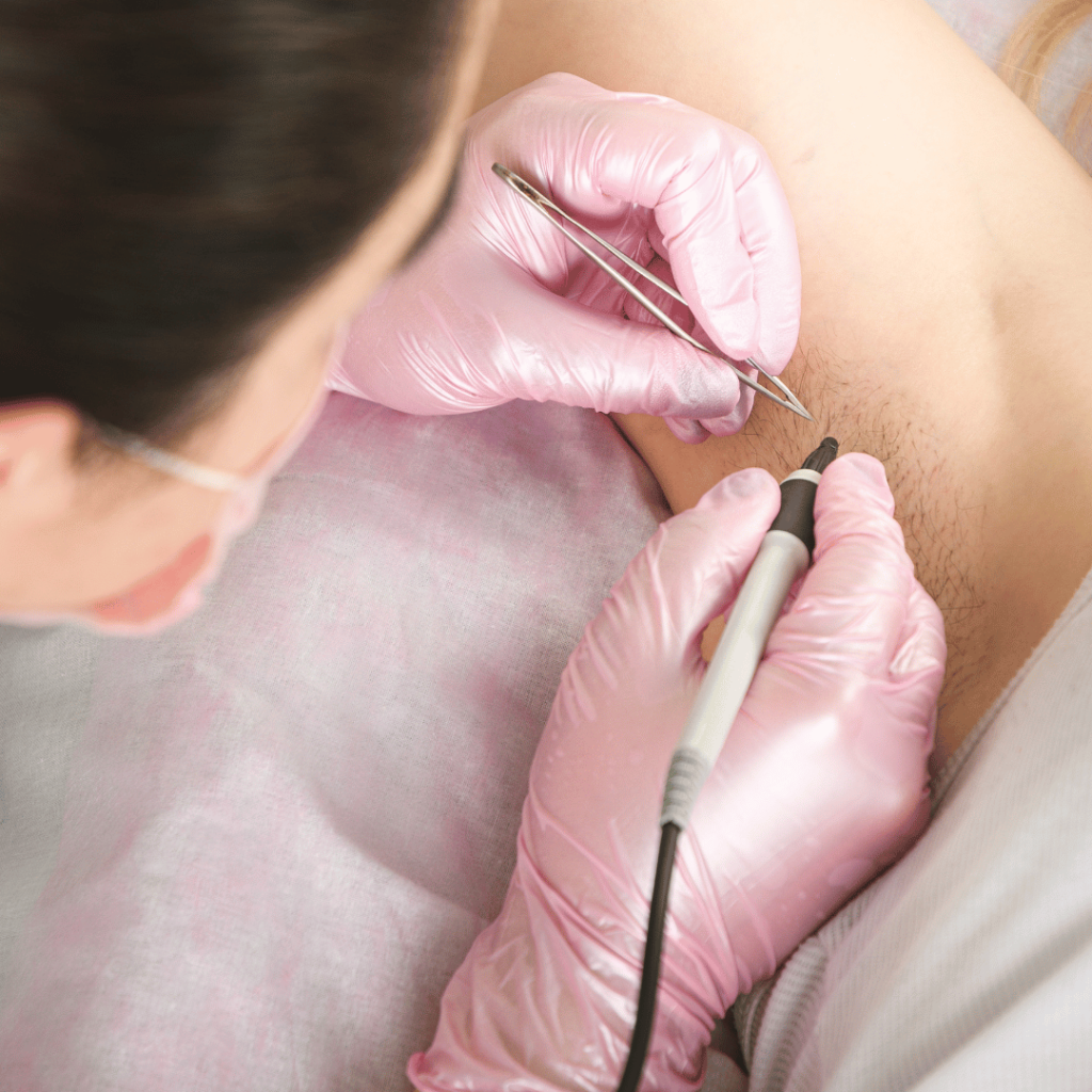 Electrolysis & Laser Hair Removal Training in Fort Myers, Florida | Laser Technician Program | Florida licensed electrology program