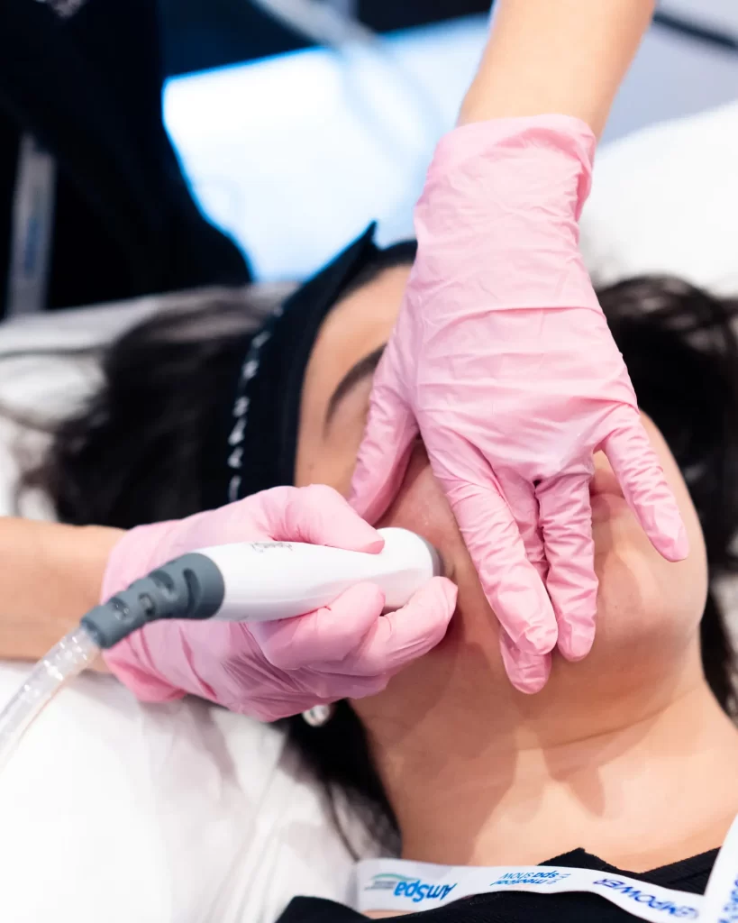 GlacÃ© Hydrodermabrasion