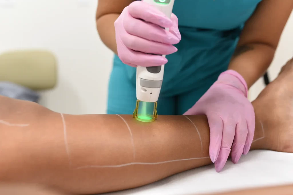 Best Laser Hair Removal School in Fort Myers